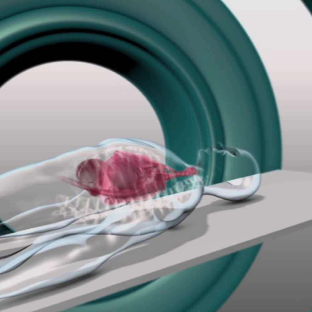 linear accelerator
