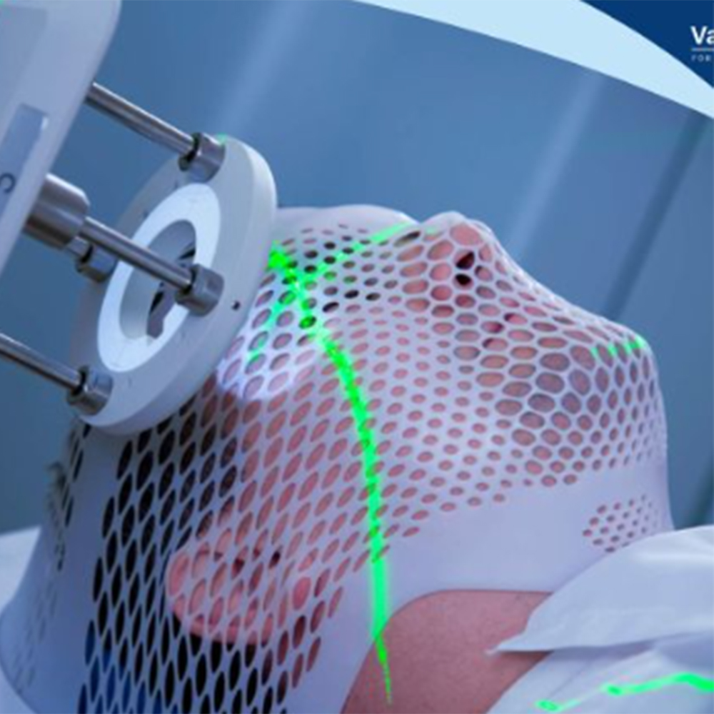 cranial radiosurgery2