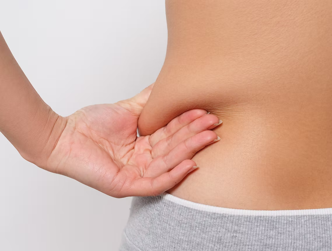 Liposuction