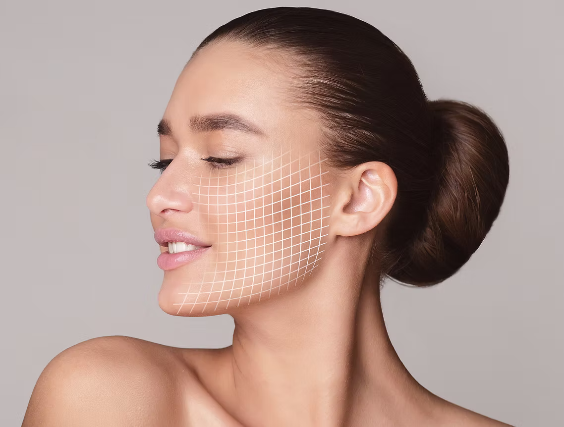 Facelift