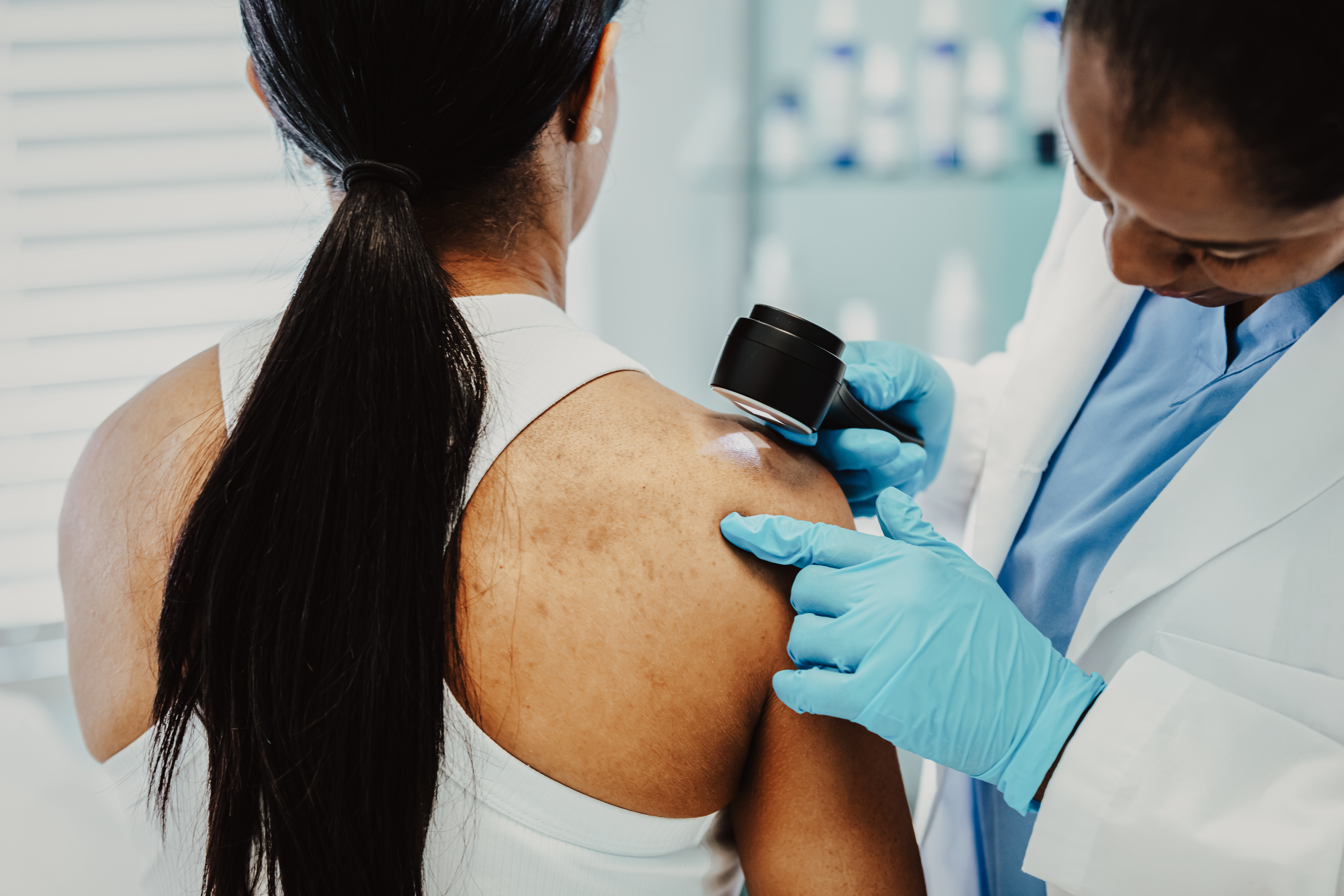 skin cancer